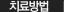 치료방법